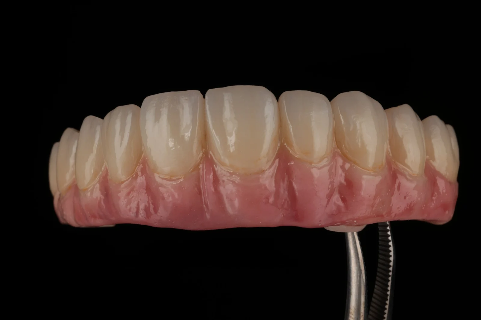 Full-arch implant prosthesis