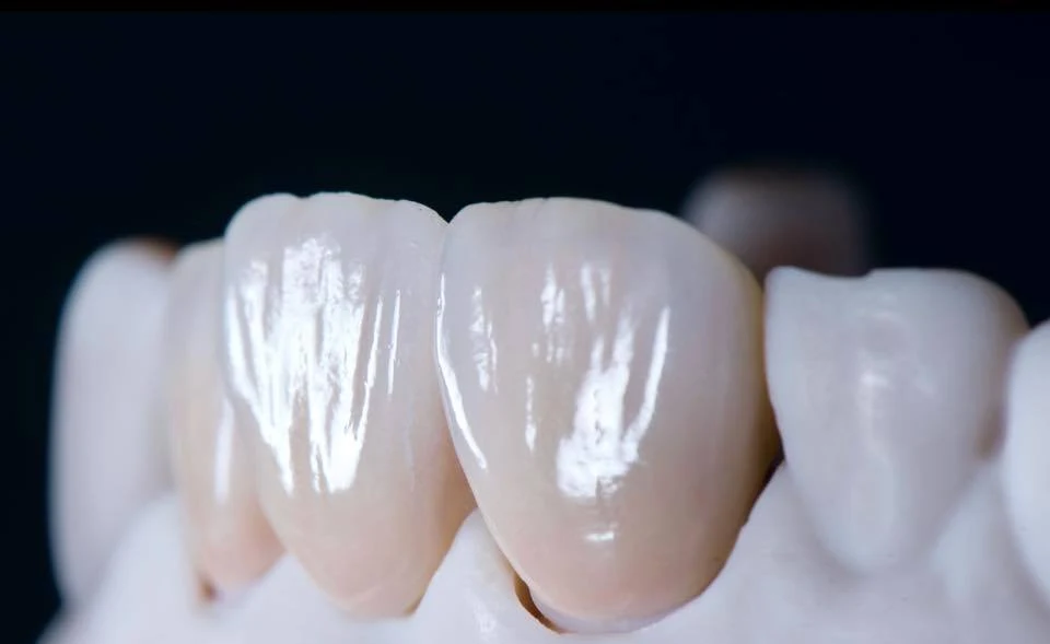 Zirconia crowns